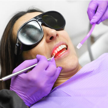 Treating Receding Gums with Correction Surgery
